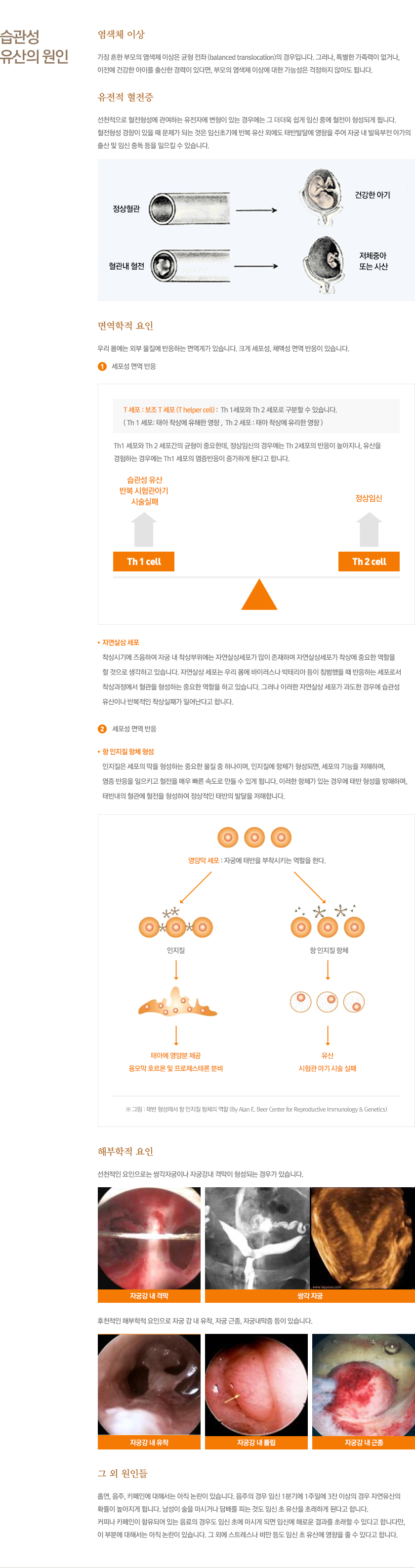 습관성유산의원인